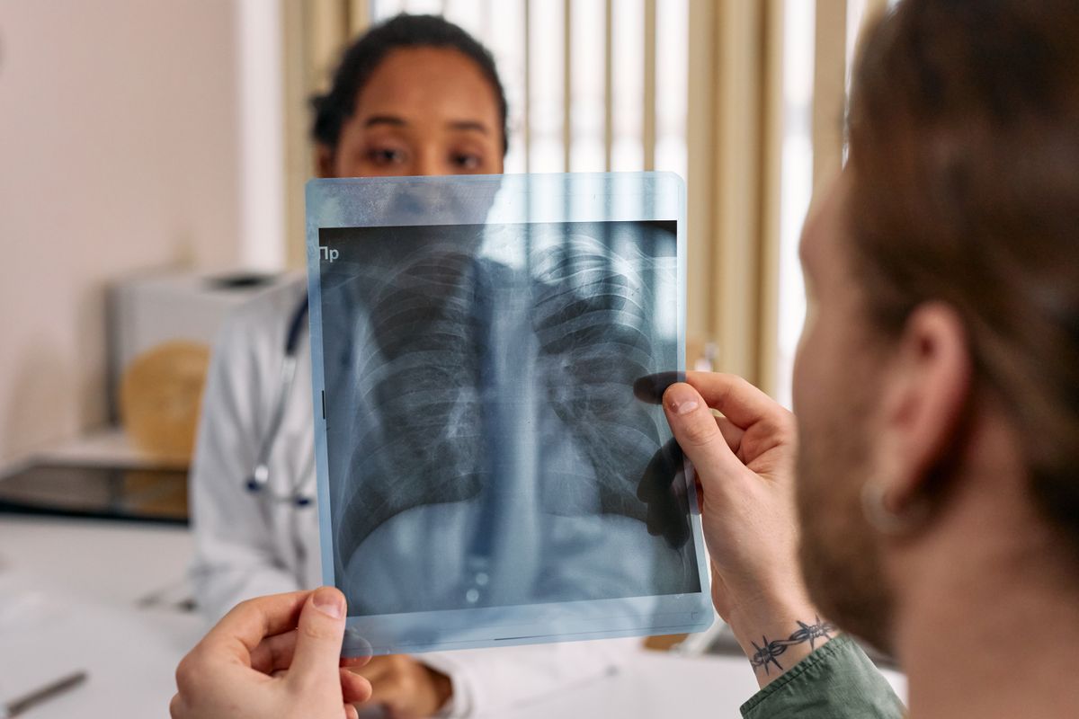 폐암 진단용 lung X-ray 검사 의사