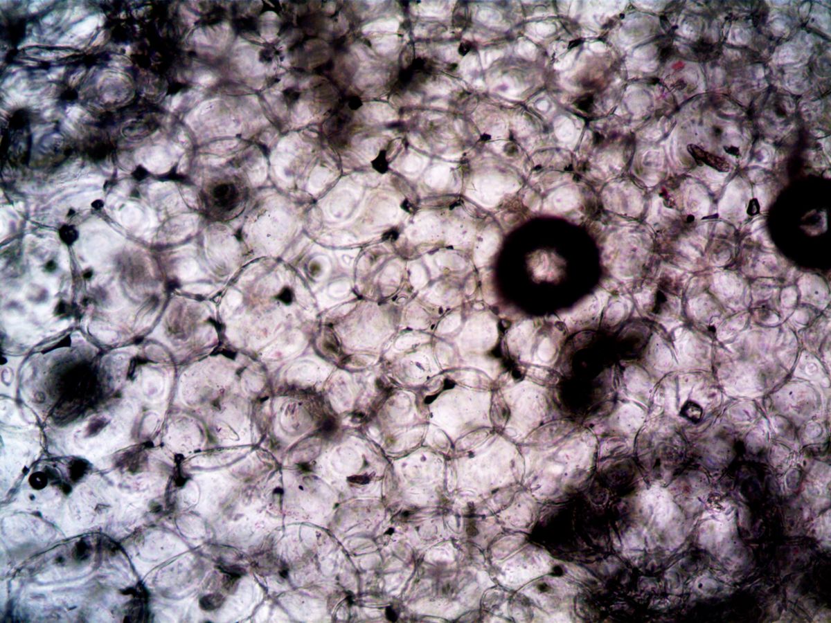 Cells의 microscopic view